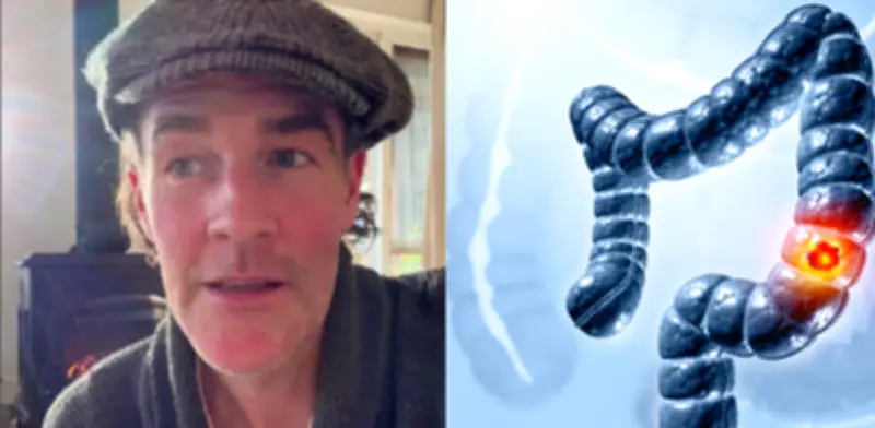 James Van Der Beek fallece a los 48 años por cáncer de colon: síntomas y alertas tempranas