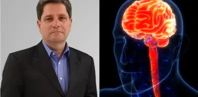 Cardiólogo revela pilares clave para prevenir accidentes cerebrovasculares y síntomas de alerta