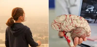 Contaminación del aire eleva riesgo de Alzheimer en mayores de 65 años según estudio de la Universidad Emory