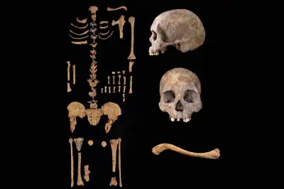 El origen mitológico de la sífilis: de la leyenda del pastor Sífilo a la ciencia moderna