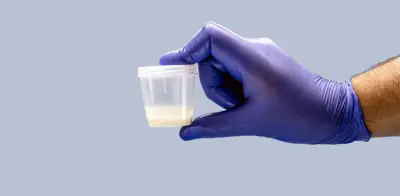 Estudio español detecta 42 químicos cotidianos en semen que amenazan fertilidad masculina