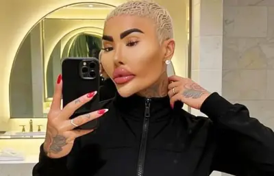 Fallece influencer británico tras cirugía estética: buscaba parecerse a Kim Kardashian