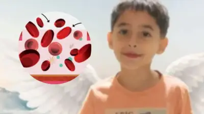 Hemofilia: qué es, cómo se detecta y el caso de Kevin Acosta en Colombia