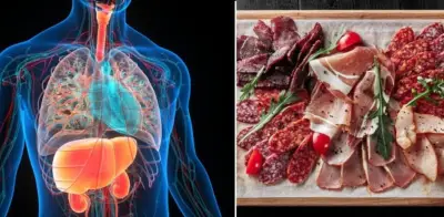 Hígado graso: por qué debe evitar salchichas, jamón y embutidos para proteger su salud