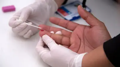 Nueva EPS deja sin tratamiento a 2.000 pacientes con VIH por falta de contratos