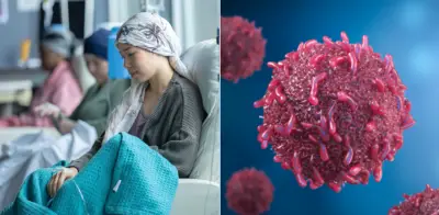 Seis tipos de cáncer aumentan rápidamente en jóvenes menores de 50 años según estudio de Harvard