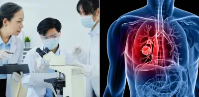 Sensor óptico chino detecta cáncer de pulmón temprano con análisis de sangre