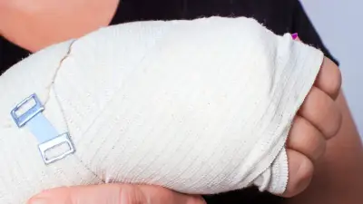 Actor mexicano Jorge Salinas sufre fractura tras caída en bicicleta