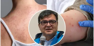 Bogotá enfrenta escasez crítica de vacunas contra el sarampión con solo 5.000 dosis disponibles