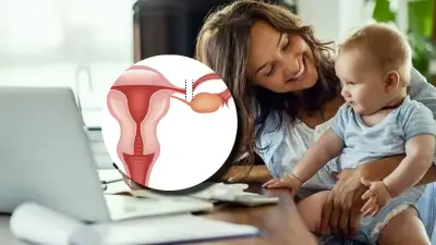 Corte Constitucional permite revertir ligadura de trompas por primera vez en Colombia