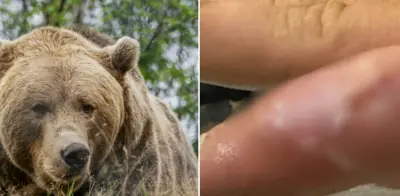 Hombre contrae rara infección 'dedo de foca' tras contacto con oso pardo en Alaska