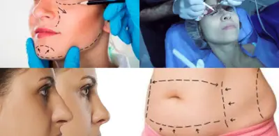 Infecciones son la principal complicación en cirugía plástica en Colombia según encuesta nacional