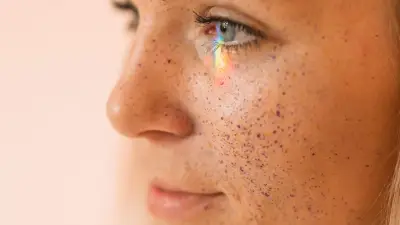 Manchas y pecas faciales: expertos revelan diferencias clave y cuidados esenciales
