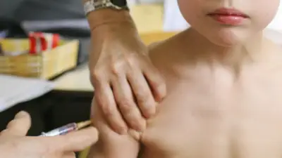 Secretario de Salud de Bogotá advierte riesgo total de sarampión en Colombia