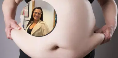 ¿Sobrepeso u obesidad? Endocrinóloga aclara diferencias y riesgos para la salud