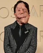 Adam Pearson brilla en los Óscar 2026: De víctima de acoso a símbolo de inclusión en Hollywood
