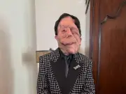 Adam Pearson: El actor con fibromatosis tipo 1 que brilló en los Óscar 2026