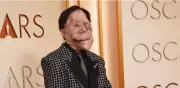 Adam Pearson y la neurofibromatosis tipo 1: la enfermedad que despertó conciencia en los Óscar 2026