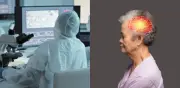 Alzhéimer progresa hasta 20 veces más rápido en mujeres por acumulación de proteínas, revela estudio