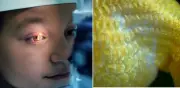 Científicos españoles crean biotejido de escamas de peces para regenerar córneas humanas