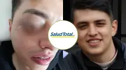 Negligencia médica en EPS Salud Total: Joven de 24 años al borde de perder su ojo por falta de atención
