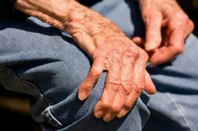 Dispositivo chileno 'Grace' elimina temblores de Parkinson sin cirugía ni fármacos