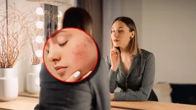 El estrés no solo afecta la mente: estudio revela cómo se refleja en la piel