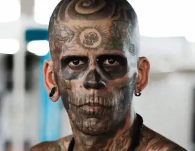El hombre más tatuado de Brasil revela su transformación tras tratamiento láser