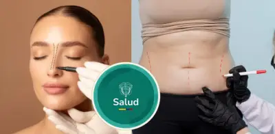 EPS en Colombia dejan de cubrir rinoplastia, liposucción y otras cirugías estéticas en 2026