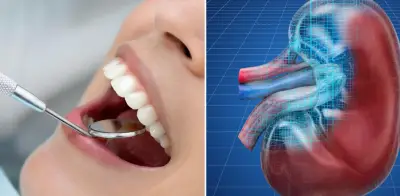 Estudio revela conexión directa entre salud dental y enfermedad renal crónica