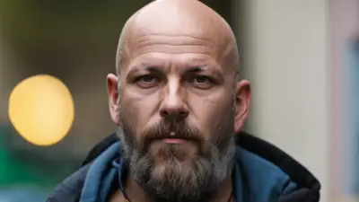 Factores clave que contribuyen a la alopecia y cómo prevenir la caída del cabello