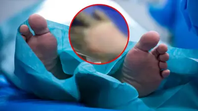 Hombre declarado muerto despierta en la morgue: insólito caso médico en Colombia