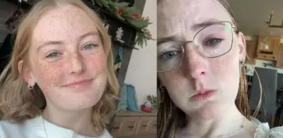 Joven pierde la vista tras ducharse con lentes de contacto