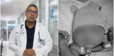 Médico revela detalles del caso de bebé que murió tras 50 días esperando cirugía cardíaca