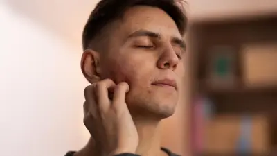 Parotiditis supera los mil casos en Colombia en 2026: síntomas y prevención