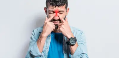 Poliposis nasal: síntomas que se confunden con alergias y afectan tu vida