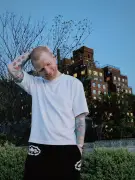 Ed Sheeran se rapa la cabeza y revela que padece culebrilla