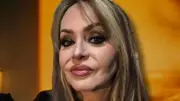 Gabriela Spanic revela su transformación tras cirugía estética: así luce ahora
