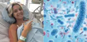 Joven de 20 años supera cáncer pulmonar ultra raro tras dolor persistente en el omóplato
