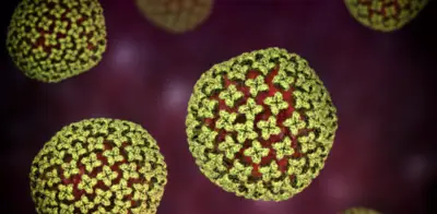 Científicos investigan posible circulación de hantavirus en Ushuaia tras casos en crucero