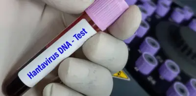 Hantavirus en crucero: cepa Andes es transmisible entre humanos, confirma OMS