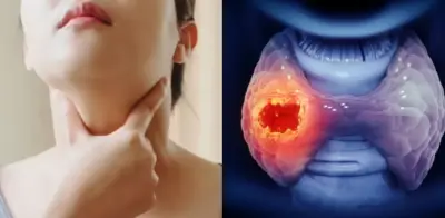 Hipotiroidismo e hipertiroidismo: señales de alerta en mujeres colombianas