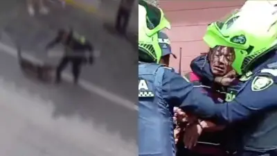 Policía dispara a perro en Rionegro, Antioquia: indignación nacional