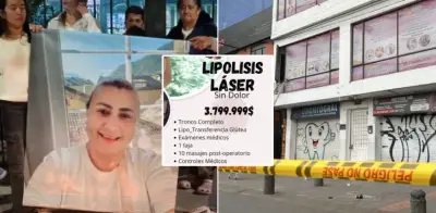 Procedimiento estético de Yulixa Toloza antes de desaparecer: dudas y cronología