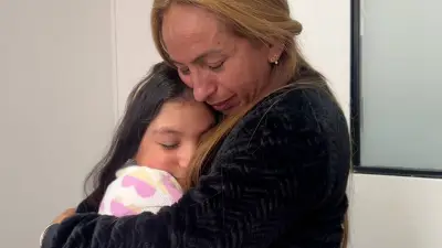 Reconstruyen cabello de niña que perdió el 70% del cuero cabelludo en Bogotá