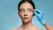 Armonización facial: el procedimiento no invasivo que reduce arrugas y gana adeptos jóvenes