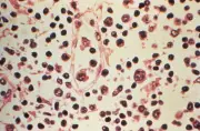 Brote de hantavirus en Argentina 2018: once muertos inició en un cumpleaños