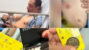 Funcionario del MinInterior herido al intentar evitar un atraco en Bogotá