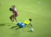 Luxofractura de peroné: la grave lesión de Romario Da Silva en Honduras