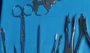Mujer vivió siete meses con tijeras quirúrgicas en el abdomen tras cirugía estética en Italia